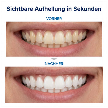 LUMIVIO™ Zahnpasta V34