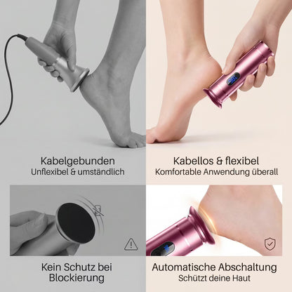 Elektrischer Hornhautentferner