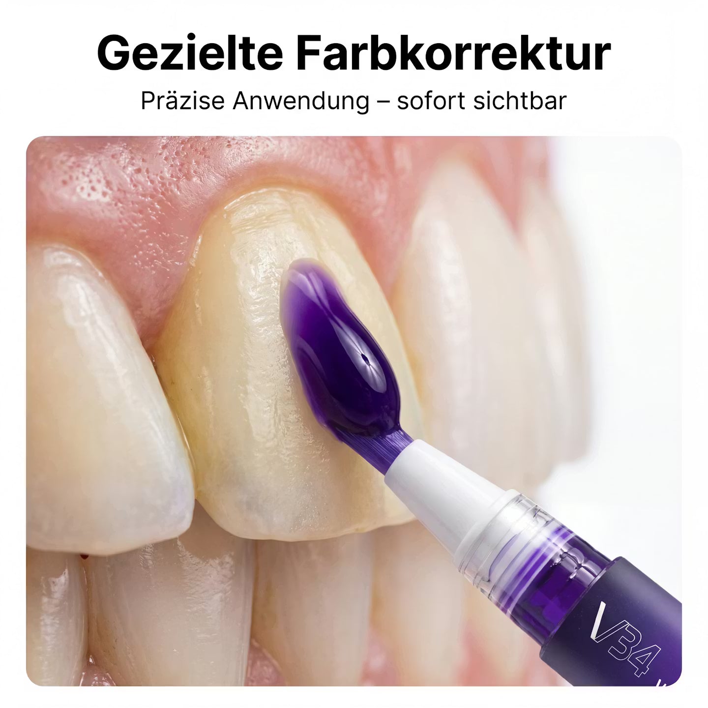 LUMIVIO™ Smile Pen V34